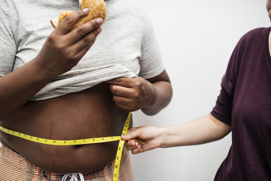 Childhood obesity is prevalent in over 20% of the US childhood population